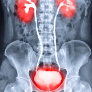 Mejora la Salud Prostática